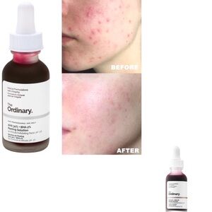 💙💙PEELING SOLUTION